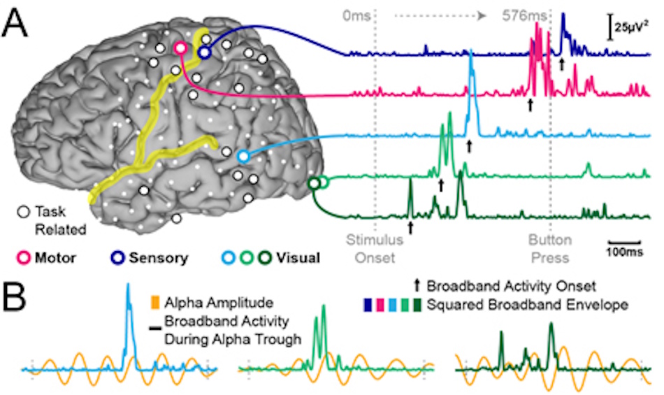 Research scientist examining detailed electroencephalography data on multiple monitors displaying brain wave patterns and neural activity measurements for BCI analysis - InfoProds 2026