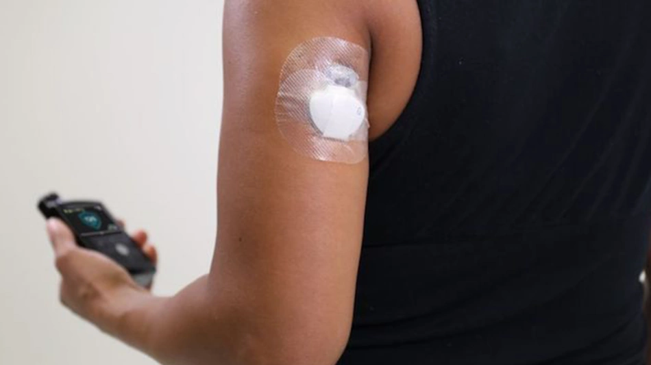 Healthcare professional demonstrating continuous glucose monitor sensor application on patient's upper arm using spring-loaded applicator showing modern diabetes technology insertion process for non-invasive blood sugar monitoring 2026 - InfoProds